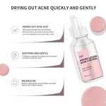 Acne Drying Lotion - OEM Private Label Hot Selling Pimple Scar Removal Calamine Serum