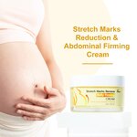 Stretch Mark Removal Cream - 100% Natural Vegan Postpartum Scar Maternity Belly Firming