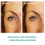 Squalane Retinol Jojoba Oil - In Stock Face Body Hair Nail Nourish Anti Aging Fine Lines