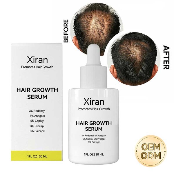 Capixyl Redensyl Serum - Private Label Hair Growth 30mL Control Fall Stimulates Growth
