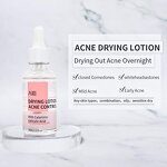 Acne Drying Lotion - OEM Private Label Hot Selling Pimple Scar Removal Calamine Serum