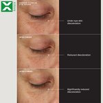 Eye Moisturizer Cream - Hot Selling Anti Wrinkle Remove Dark Circles Bags Repair Skin Care