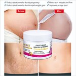 Stretch Mark Repair Cream - Top Selling Postpartum Pregnancy Slimming Anti Aging Cream