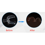 Teeth Whitening Mouth Tray - Home Used Hot Water Formed Transparent Food Grade Silicone BPA Free