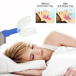 Dental Guard - Professional Anti Snoring Silicone Mouth Tray Teeth Grinding Whitening Device