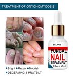 Fungal Nail Destroyer - Best Seller Wholesale Effective Anti-Fungal Finger Toe Nail Repair