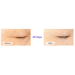 Microcurrent Fabric Mask - Manufacturer - Skin Firming for Wrinkle Care Moisturizing