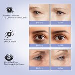 Gel Eye Patch Manufacturer - Factory Wholesale Oem Under Eye Sheet Custom logo Hydrogel & Private Label