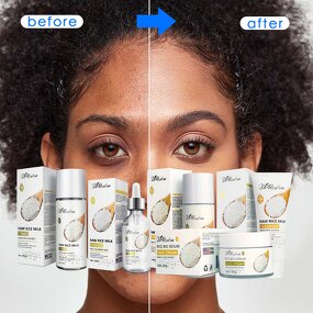 Skin Care Set Manufacturer - DR.ROSEVA Face Sulfate-free Moisturizer & Nourishing and Hyaluronic Acid Rice Extract Anti Aging