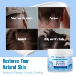 Seborrheic Dermatitis Cream Manufacturer - Wholesale New Products Herbal Extraction Psoriasis Treatment