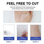 Scar Treatment Sheets Manufacturer - Elaimei 4cm*3m Silicone Transparent Reusable Washable Stretch Mark Burn Surgery Scars Removal