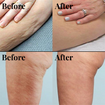 Gua Sha Instrument Manufacturer - Smart Wireless Charging Electric Large Suction Meridian Brush Bian Stone for Body Hot Compress Cupping