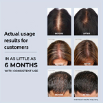 Infrared Head Massager Manufacturer - Electric Heating Thick Hair Cross-Border Anti-Hair Loss Care Far-Infrared Hair Cap