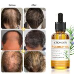 Scalp Massage Oil Manufacturer - OEM ODM Organic Herbal Extract Rosemary Stimulate Hair Care Growth Prevent Hair Loss Treatment Essential Oils