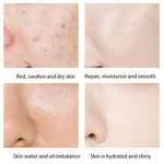 Facial Serum Manufacturer - Custom OEM Face Skin Care Hyaluronic Whitening Salicylic Acid Anti Aging Wrinkle Acne Vitamin C E Peptides Ampule