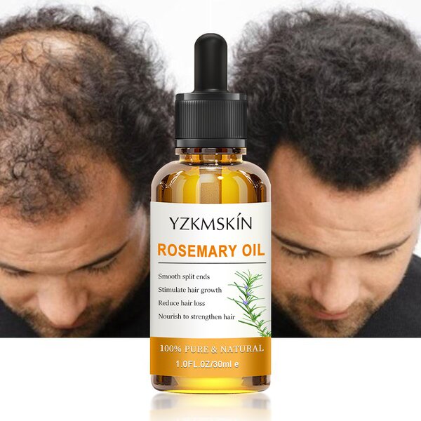 Scalp Massage Oil Manufacturer - OEM ODM Organic Herbal Extract Rosemary Stimulate Hair Care Growth Prevent Hair Loss Treatment Essential Oils