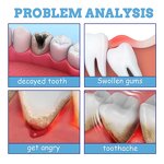 Oral Care Antimicrobial Ointment Manufacturer - 20ml Herbal Toothache Relief Spray for Swollen Gums Cavities