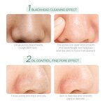 Mud Mask Manufacturer - Laikou Deep Cleansing Oil Control Anti Acne Tea Tree