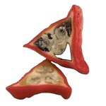 Thaumatin Powder Manufacturer - 100% Natural Katemfe Fruit Extract