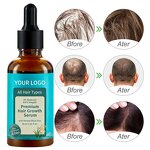 Hair Treatment Serum - 30ml with Anagain & Biotin