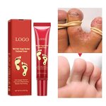 Foot Cream - Herbal Effective & Anti Fungal Infection