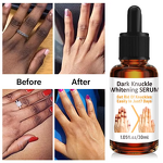 Whitening Serum - Private Label for Dark Knuckles & Elbows