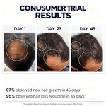 Hair Treatment Serum - 30ml with Anagain & Biotin