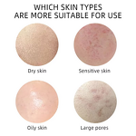 Facial Cleanser - Rose Sulfate-Free Amino Mousse & Acne