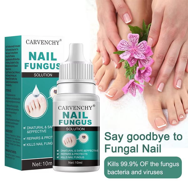 Nail Polish Essence - 10ml Natural & Herbal Fungus Solution