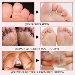 Foot Cream - Herbal Effective & Anti Fungal Infection