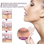 Acne Scar Serum - Vitamin C & EGF & Dry Skin