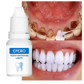 Teeth Whitening Liquid - Vitamine De Fesse Portable & for Home