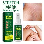 Stretch Mark Spray - Natural Vegan & Postpartum Vergeture Removal