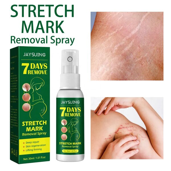 Stretch Mark Spray - Natural Vegan & Postpartum Vergeture Removal