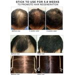 Hair Growth Oil - Wholesale Custom Private Label & Organic