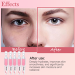 Bio Needles Peeling Mask Manufacturer - Herbal Face Peeling Algae Peel Bio Microneedling for Acne/Hyperpigmentation