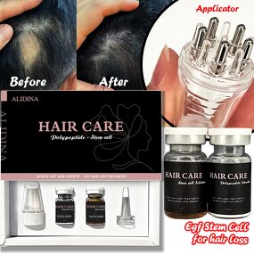 Stem Cell Serum Manufacturer - Lyophilized Powder with Applicator Hair Massager for Growth