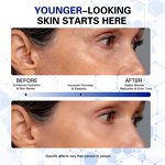 Algae Peel Set Manufacturer - Biomicroneedling Spongilla Spicules Natural Algae Peel Off Mask Powder