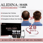 Hair Regrowth Powder Manufacturer - Growth Factor Lyophilized Stem Cell Peptides & Private Logo