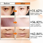 Anti Acne Facial Serum Manufacturer - Private Label 30ml Shot 7500PPM for Brightening Body Skin