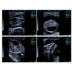 Portable Veterinary Ultrasound Scanner Manufacturer - for Dogs, Cats, Livestock