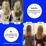 Private Label Biotin Collagen Gummies Hair Growth Supplement with Keratin for Stronger Strands Beauty Product Gummy Candy Dosage