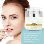 Freckle Removal Cream Manufacturer - Private Label, Custom Logo, Anti-Freckle & Dark Spot Corrector