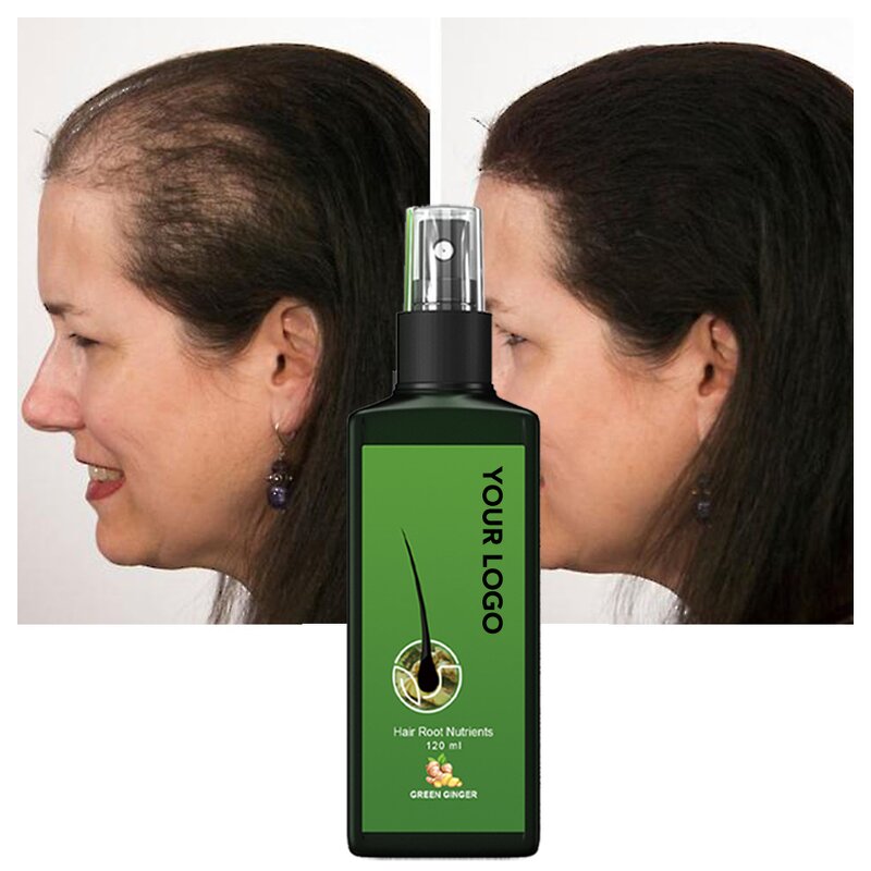 Men Rosemary Oil Hair Growth Spray - Herbal Formula with Ginger & Rice Water Serum
Hair Growth Spray - Rosemary & Ginger Herbal Formula with Rice Water Serum for Men