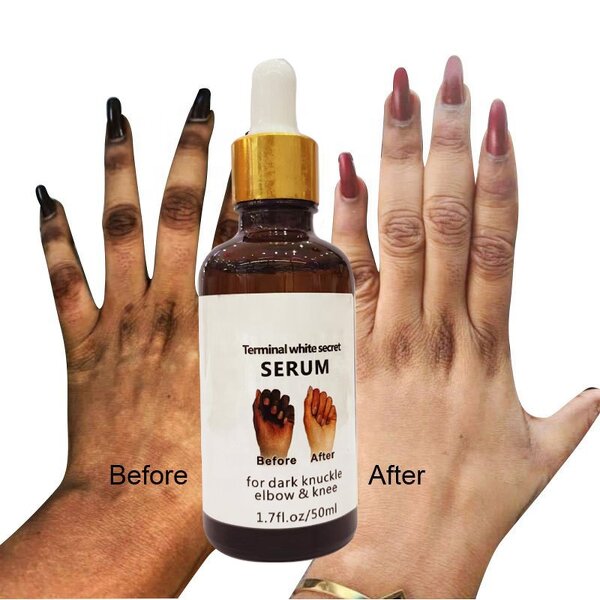 Whitening Serum for Dark Knuckles Manufacturer - Elbow and Knee Lightening Serum