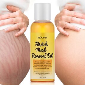 Lemon Essential Oil for Stretch Marks - Natural Organic Scar Removal Treatment