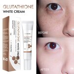 Melasma Blemish Removal Cream - Dark Spot & Freckle Remover for Face
