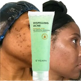 Salicylic Acid Facial Cleanser Manufacturer - 2% Formula with Amino Acids, Green Tea & Bamboo for Anti-Acne Deep Clean