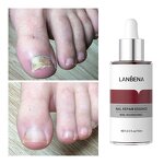 LANBENA Nail Repair Serum Manufacturer - Damaged Nails & Feet Care Strength Liquid