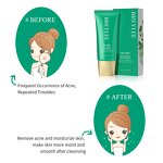 Tea Tree Facial Cleanser Manufacturer - Deep Cleansing Face Wash for Acne